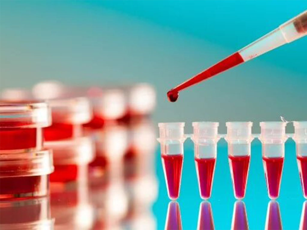 THROMBOPHILIA TESTING