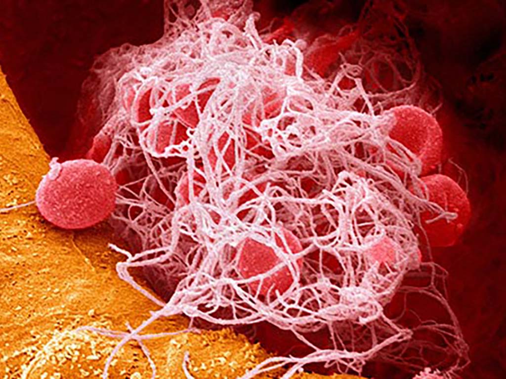 RISK FACTORS & PREDISPOSING CONDITIONS