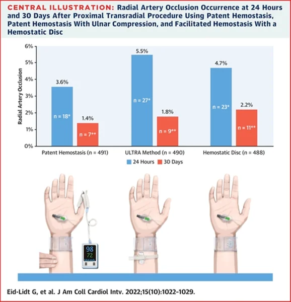 Prevention of Radial Artery Occlusion of 3 Hemostatic Methods in Transradial Intervention for Coronary Angiography